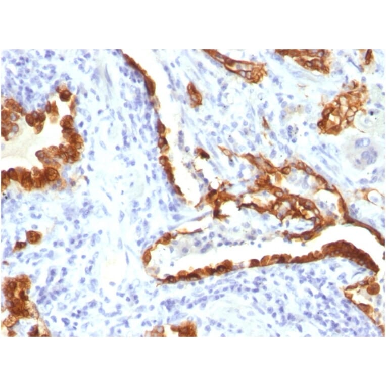 Immunohistochemistry - Anti-Cytokeratin 18 Antibody [KRT18/834] (A249199) - Antibodies.com