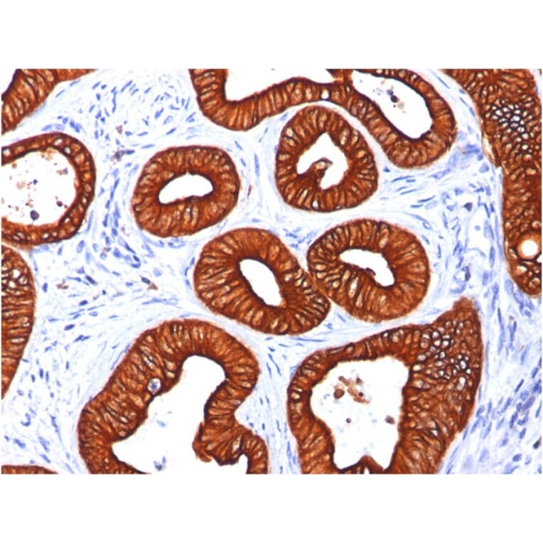 Immunohistochemistry - Anti-Cytokeratin 18 Antibody [KRT18/834] (A249199) - Antibodies.com