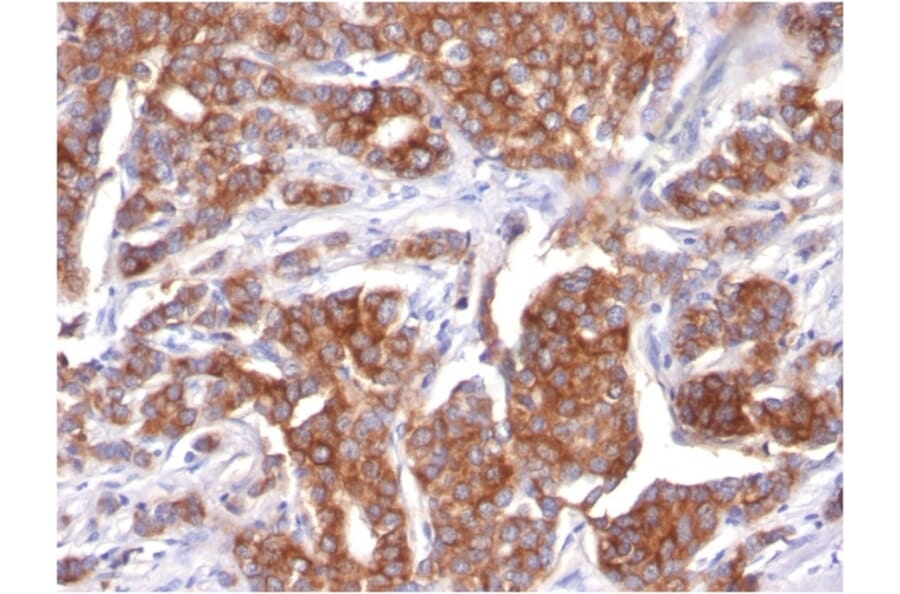 Immunohistochemistry - Anti-Cytokeratin 18 Antibody [KRT18/834] (A249199) - Antibodies.com