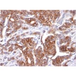 Immunohistochemistry - Anti-Cytokeratin 18 Antibody [KRT18/834] (A249199) - Antibodies.com