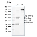 SDS-PAGE - Anti-Cytokeratin 18 Antibody [KRT18/834] (A249199) - Antibodies.com