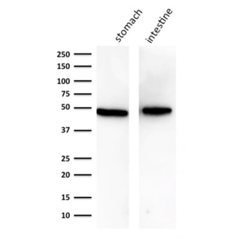 Western Blot - Anti-Cytokeratin 18 Antibody [KRT18/834] (A249199) - Antibodies.com