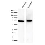 Western Blot - Anti-Cytokeratin 18 Antibody [KRT18/834] (A249199) - Antibodies.com