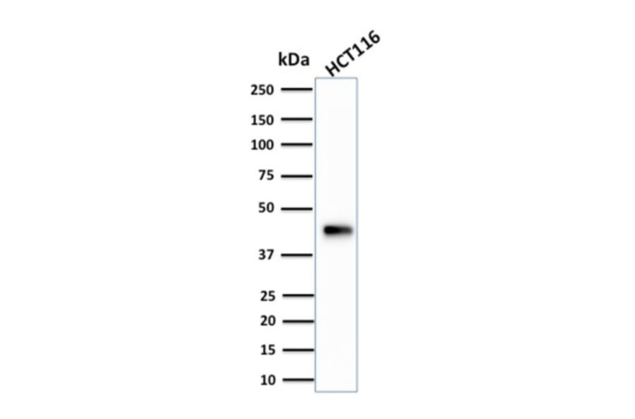 Western Blot - Anti-Cytokeratin 18 Antibody [KRT18/834] (A249199) - Antibodies.com