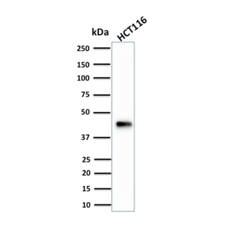 Western Blot - Anti-Cytokeratin 18 Antibody [KRT18/834] (A249199) - Antibodies.com