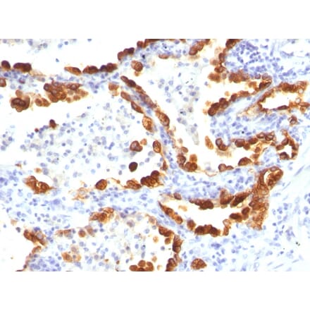 Immunohistochemistry - Anti-Cytokeratin 18 Antibody [KRT18/835] (A249200) - Antibodies.com