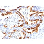 Immunohistochemistry - Anti-Cytokeratin 18 Antibody [KRT18/835] (A249200) - Antibodies.com
