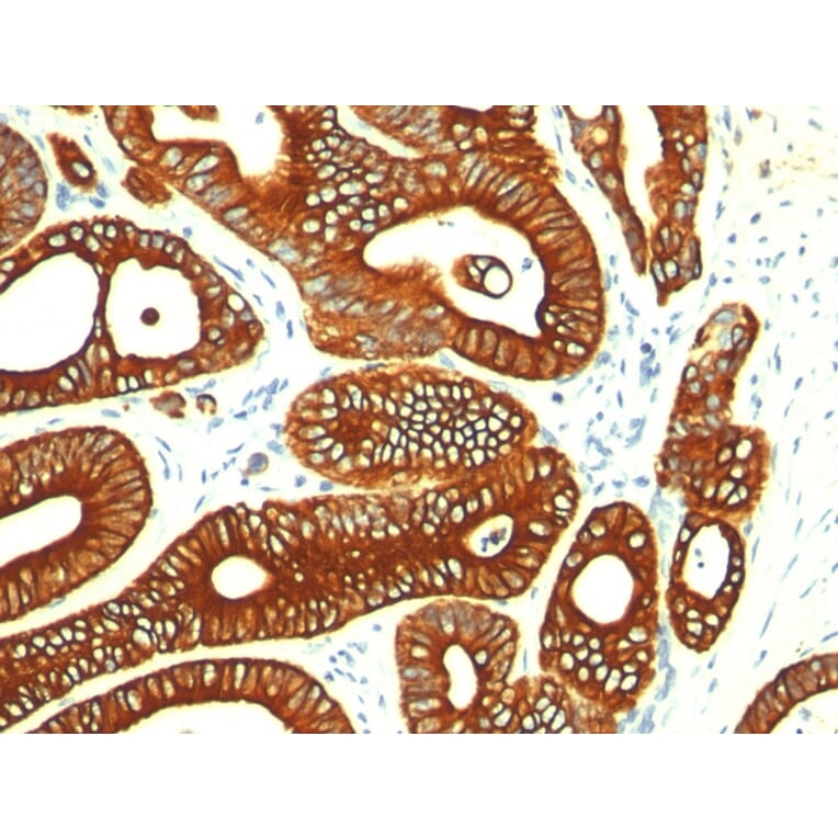 Immunohistochemistry - Anti-Cytokeratin 18 Antibody [KRT18/835] (A249200) - Antibodies.com