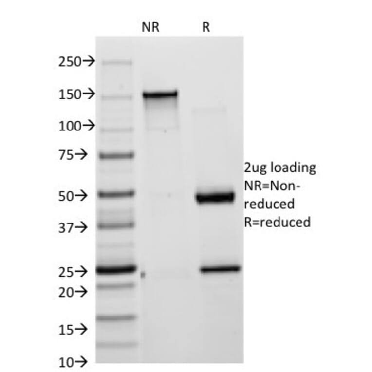 SDS-PAGE - Anti-Cytokeratin 18 Antibody [KRT18/835] (A249200) - Antibodies.com