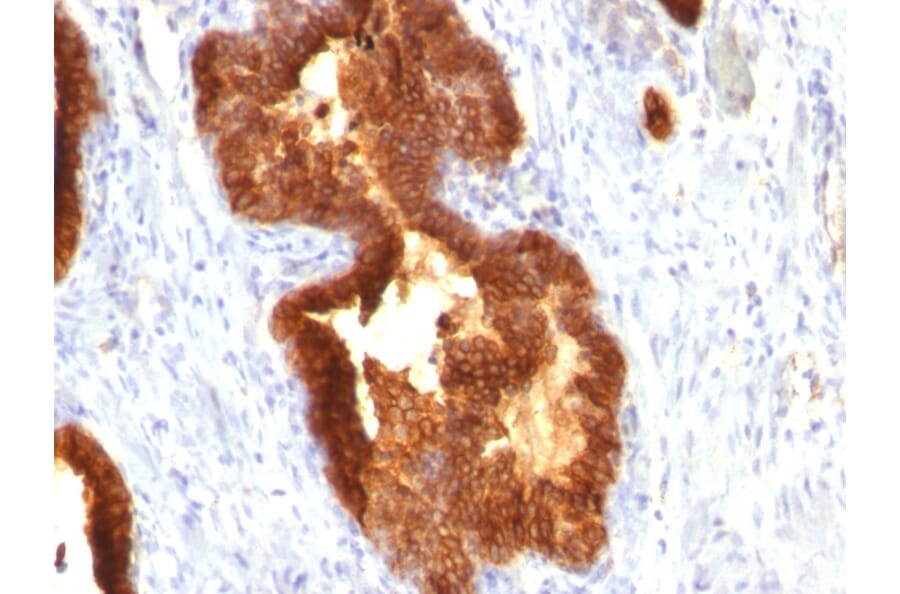 Immunohistochemistry - Anti-Cytokeratin 18 Antibody [KRT18/835] (A249200) - Antibodies.com