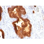 Immunohistochemistry - Anti-Cytokeratin 18 Antibody [KRT18/835] (A249200) - Antibodies.com