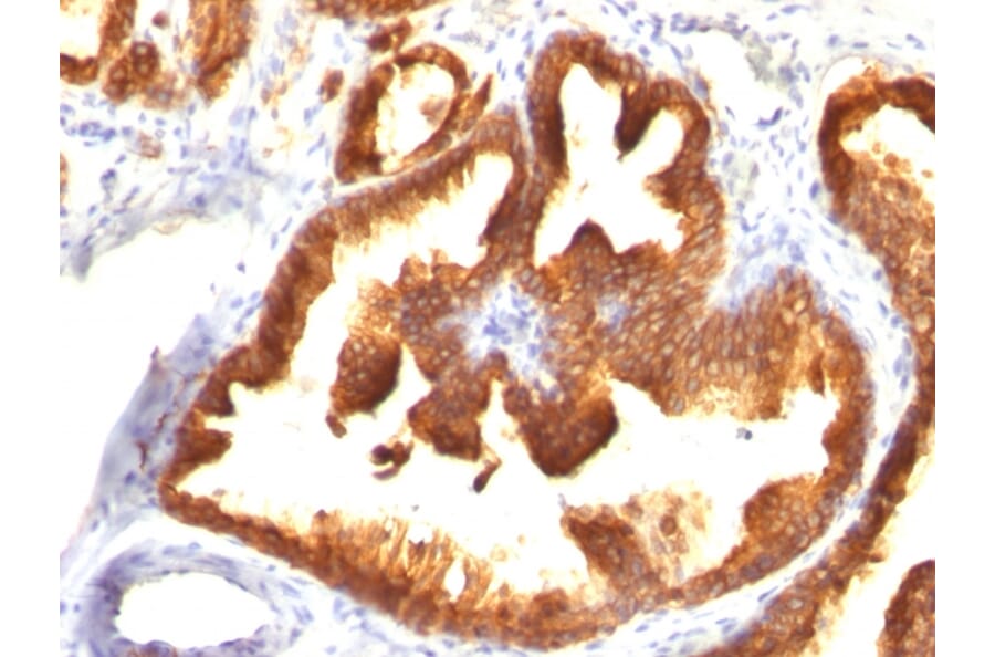 Immunohistochemistry - Anti-Cytokeratin 18 Antibody [KRT18/836] (A249201) - Antibodies.com