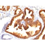 Immunohistochemistry - Anti-Cytokeratin 18 Antibody [KRT18/836] (A249201) - Antibodies.com