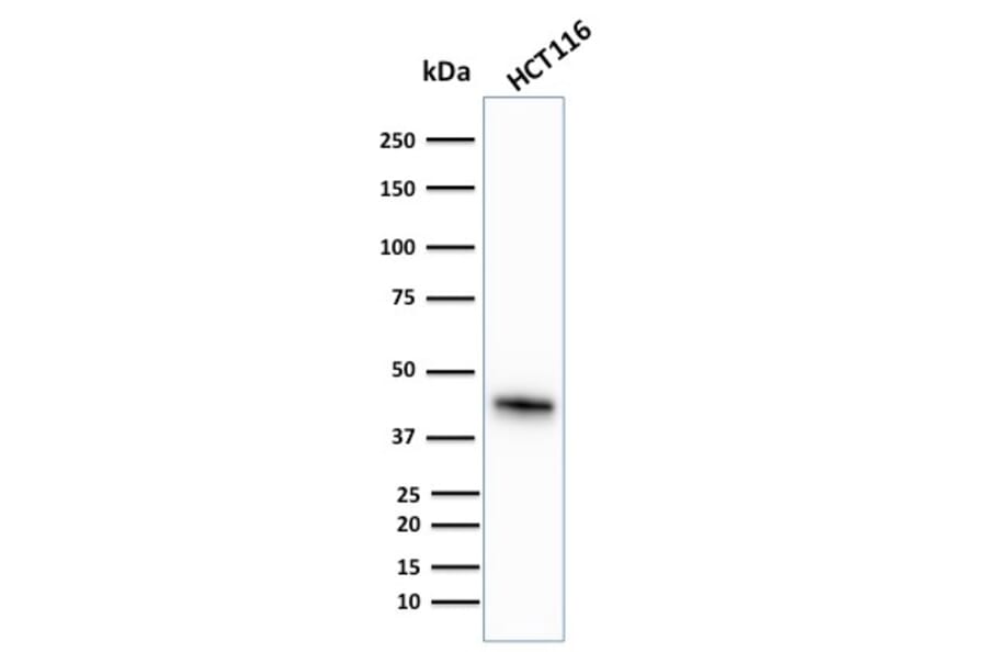 Western Blot - Anti-Cytokeratin 18 Antibody [KRT18/836] (A249201) - Antibodies.com