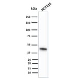 Western Blot - Anti-Cytokeratin 18 Antibody [KRT18/836] (A249201) - Antibodies.com