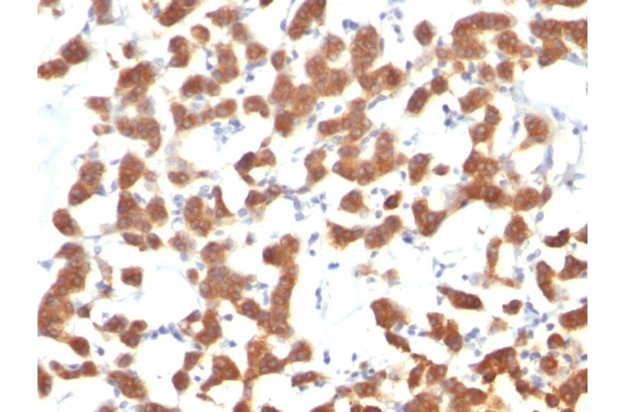 Immunohistochemistry - Anti-Cytokeratin 18 Antibody [C-04] (A249202) - Antibodies.com