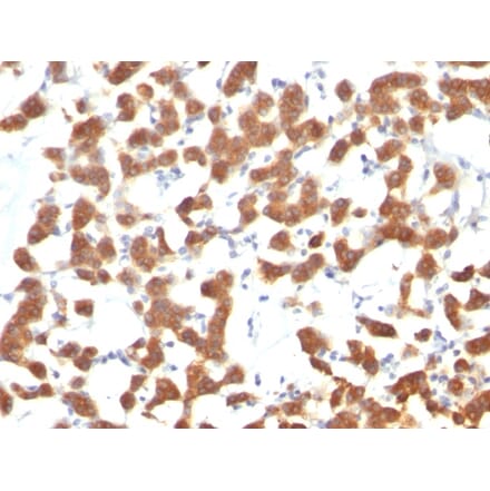 Immunohistochemistry - Anti-Cytokeratin 18 Antibody [C-04] (A249202) - Antibodies.com
