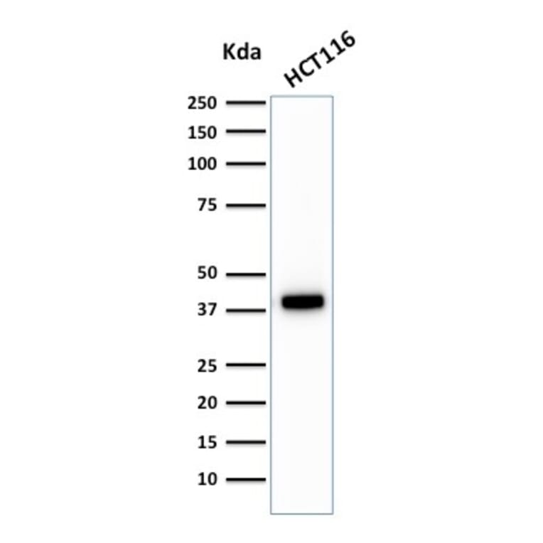 Western Blot - Anti-Cytokeratin 18 Antibody [C-04] (A249202) - Antibodies.com