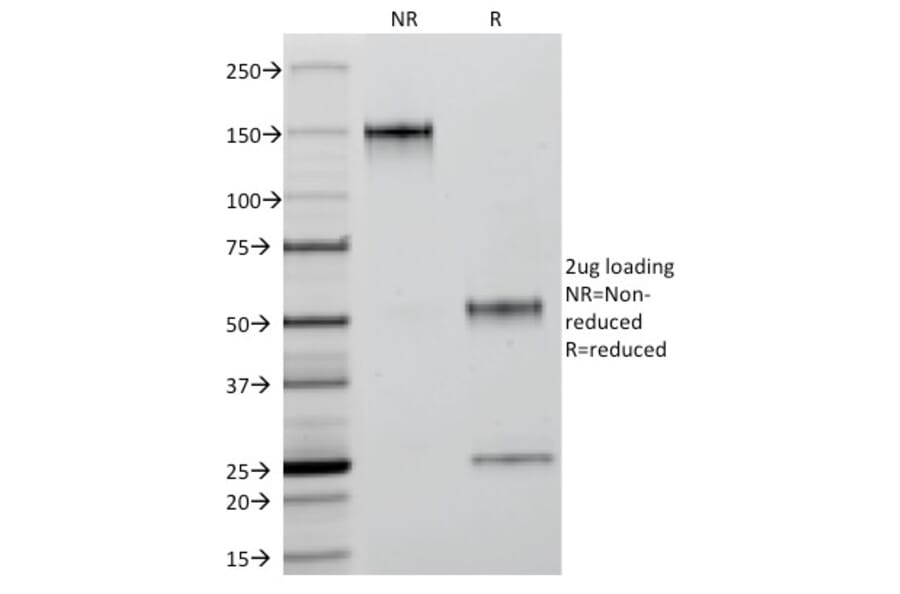SDS-PAGE - Anti-Cytokeratin 18 Antibody [C-04] (A249202) - Antibodies.com