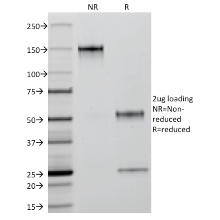 SDS-PAGE - Anti-Cytokeratin 18 Antibody [C-04] (A249202) - Antibodies.com