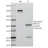 SDS-PAGE - Anti-Cytokeratin 18 Antibody [C-04] (A249202) - Antibodies.com