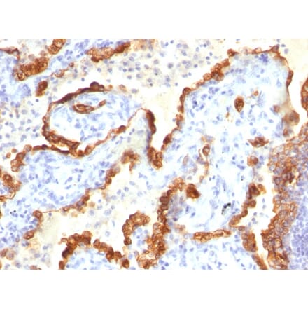 Immunohistochemistry - Anti-Cytokeratin 18 Antibody [Cocktail KRT18] (A249203) - Antibodies.com