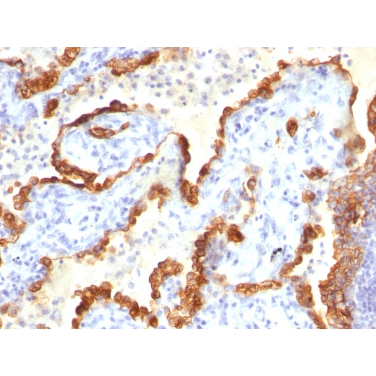 Immunohistochemistry - Anti-Cytokeratin 18 Antibody [Cocktail KRT18] (A249203) - Antibodies.com