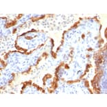 Immunohistochemistry - Anti-Cytokeratin 18 Antibody [Cocktail KRT18] (A249203) - Antibodies.com