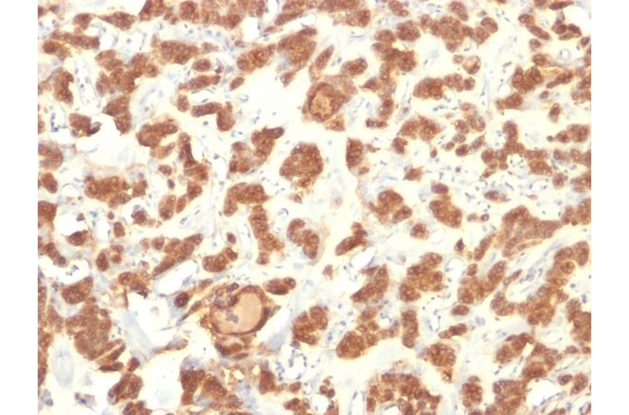 Immunohistochemistry - Anti-Cytokeratin 18 Antibody [Cocktail KRT18] (A249203) - Antibodies.com