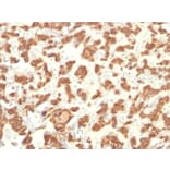 Immunohistochemistry - Anti-Cytokeratin 18 Antibody [Cocktail KRT18] (A249203) - Antibodies.com