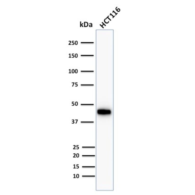 Western Blot - Anti-Cytokeratin 18 Antibody [Cocktail KRT18] (A249203) - Antibodies.com