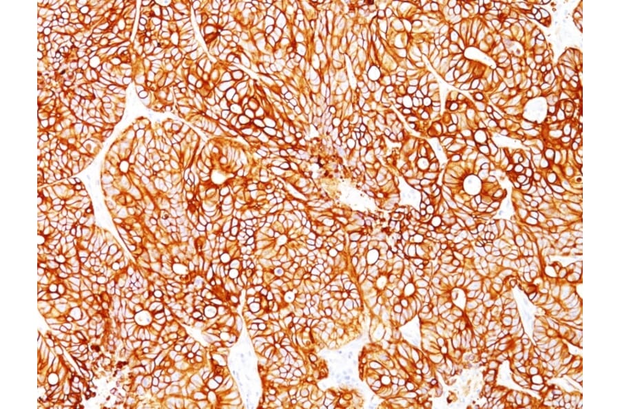 Immunohistochemistry - Anti-Cytokeratin 18 Antibody [Cocktail KRT18] (A249203) - Antibodies.com