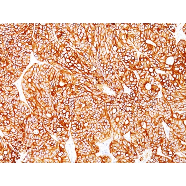 Immunohistochemistry - Anti-Cytokeratin 18 Antibody [Cocktail KRT18] (A249203) - Antibodies.com
