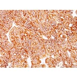 Immunohistochemistry - Anti-Cytokeratin 18 Antibody [Cocktail KRT18] (A249203) - Antibodies.com