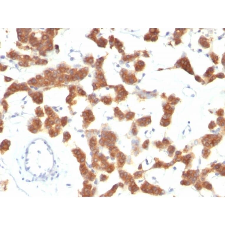 Immunohistochemistry - Anti-Cytokeratin 18 Antibody [B23.1] (A249203) - Antibodies.com