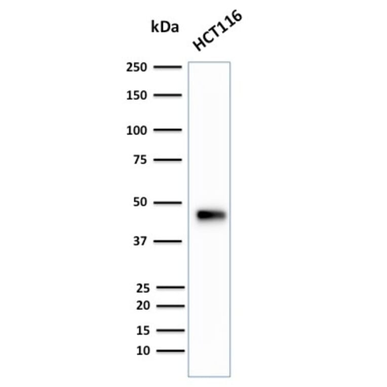 Western Blot - Anti-Cytokeratin 18 Antibody [B23.1] (A249204) - Antibodies.com