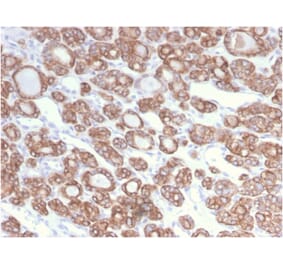 Immunohistochemistry - Anti-Cytokeratin 18 Antibody [KRT18/2808R] (A249205) - Antibodies.com