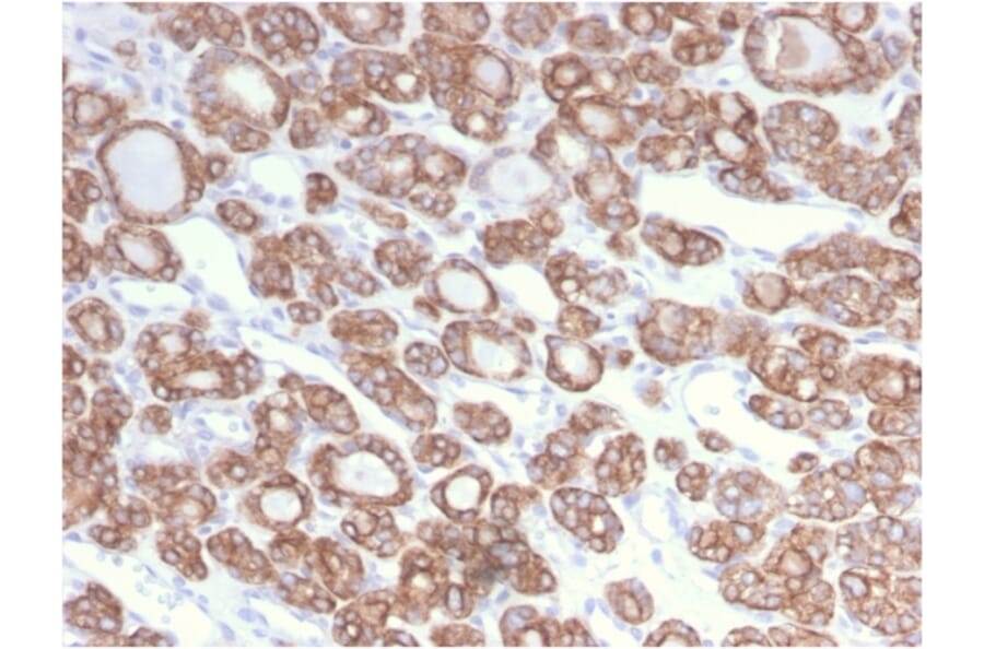 Immunohistochemistry - Anti-Cytokeratin 18 Antibody [KRT18/2808R] (A249205) - Antibodies.com