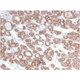 Immunohistochemistry - Anti-Cytokeratin 18 Antibody [KRT18/2808R] (A249205) - Antibodies.com