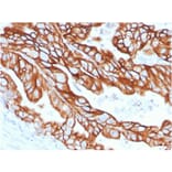 Immunohistochemistry - Anti-Cytokeratin 18 Antibody [KRT18/2808R] (A249205) - Antibodies.com
