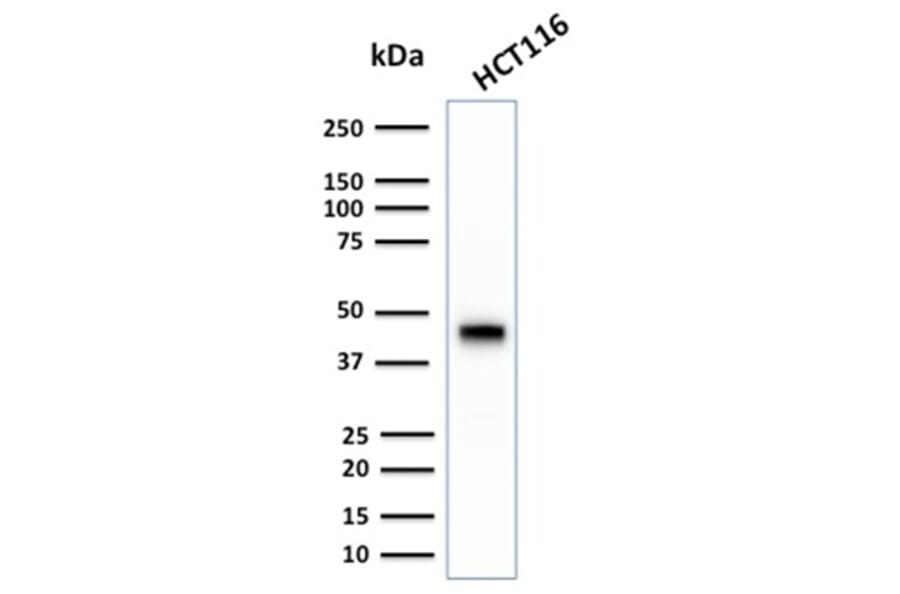Western Blot - Anti-Cytokeratin 18 Antibody [KRT18/2808R] (A249205) - Antibodies.com