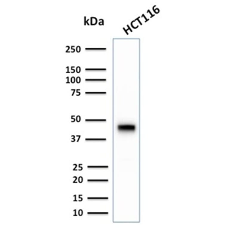 Western Blot - Anti-Cytokeratin 18 Antibody [KRT18/2808R] (A249205) - Antibodies.com