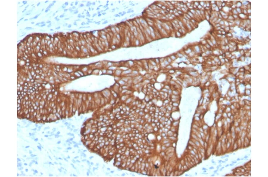 Immunohistochemistry - Anti-Cytokeratin 18 Antibody [KRT18/2819R] (A249206) - Antibodies.com