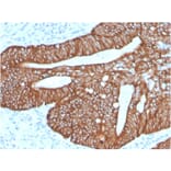 Immunohistochemistry - Anti-Cytokeratin 18 Antibody [KRT18/2819R] (A249206) - Antibodies.com
