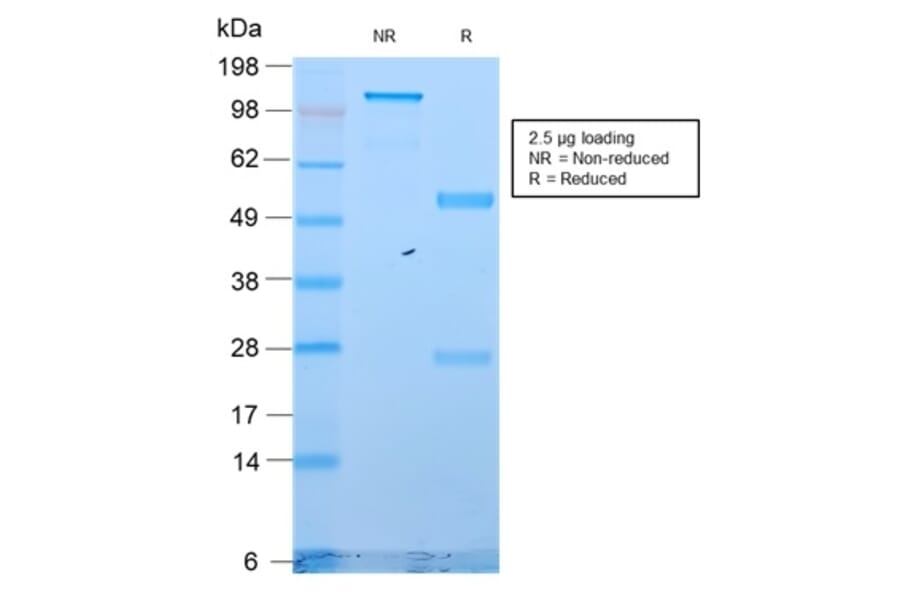 SDS-PAGE - Anti-Cytokeratin 18 Antibody [KRT18/2819R] (A249206) - Antibodies.com