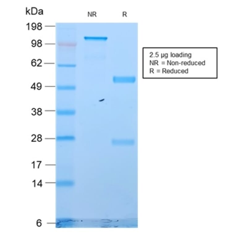 SDS-PAGE - Anti-Cytokeratin 18 Antibody [KRT18/2819R] (A249206) - Antibodies.com