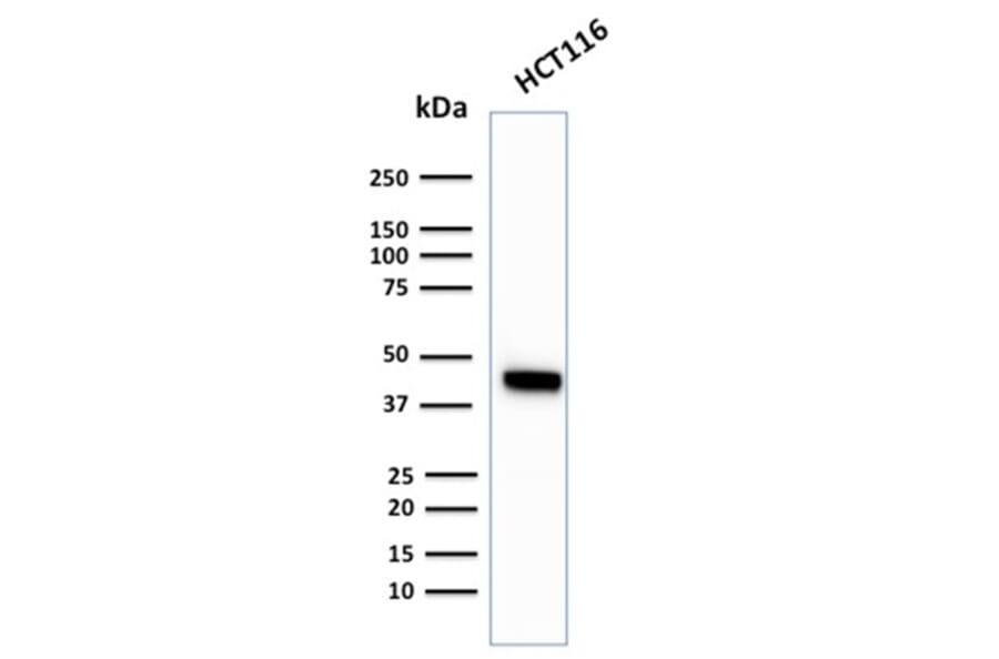 Western Blot - Anti-Cytokeratin 18 Antibody [KRT18/2819R] (A249206) - Antibodies.com