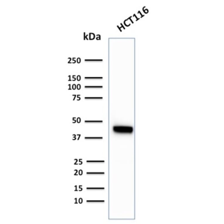 Western Blot - Anti-Cytokeratin 18 Antibody [KRT18/2819R] (A249206) - Antibodies.com