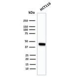 Western Blot - Anti-Cytokeratin 18 Antibody [KRT18/2819R] (A249206) - Antibodies.com