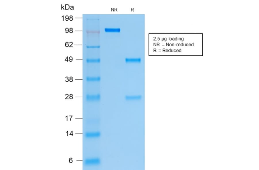 SDS-PAGE - Anti-Cytokeratin 19 Antibody [rKRT19/799] (A249207) - Antibodies.com